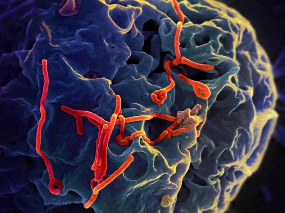 Bệnh viện CATP: Thông tin và khuyến cáo các biện pháp phòng, chống bệnh do virus Ebola